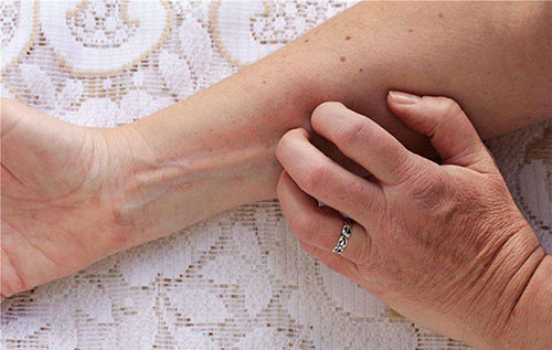 AB膠皮膚過(guò)敏解決辦法